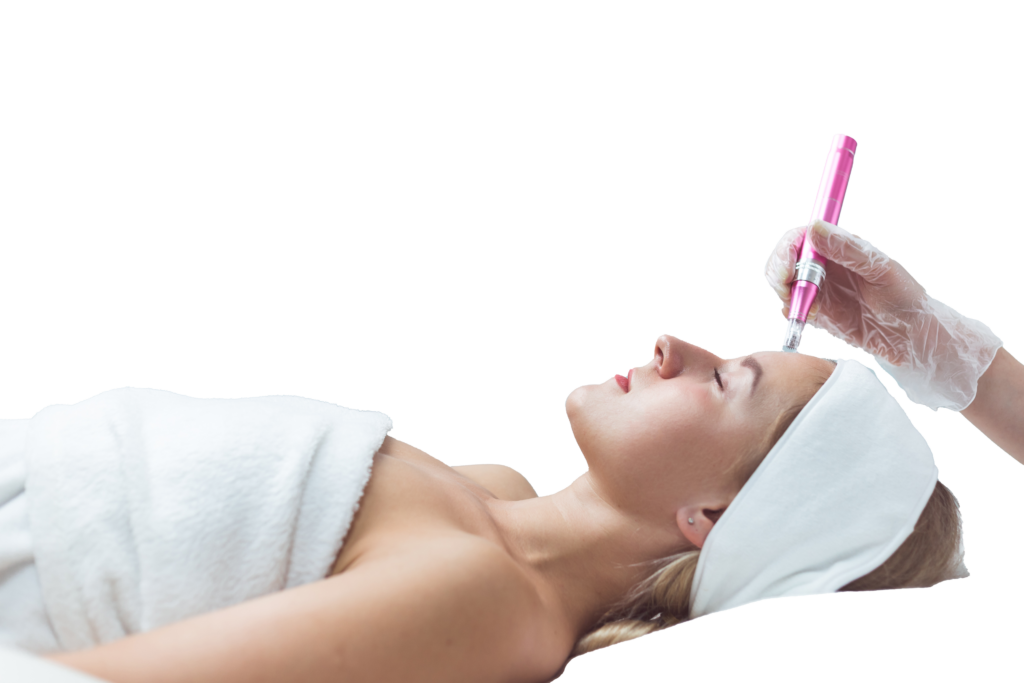 MICRO-NEEDLING MICRO-NEEDLING